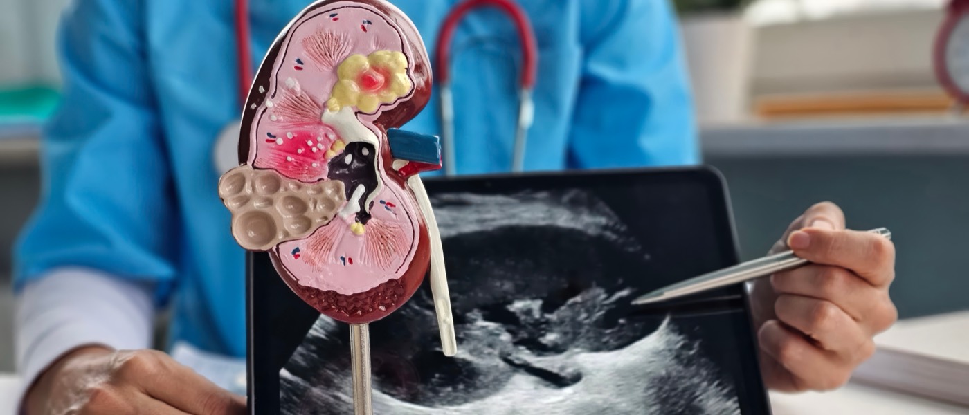Doctor demonstrating a kidney model while discussing ultrasound results with a patient