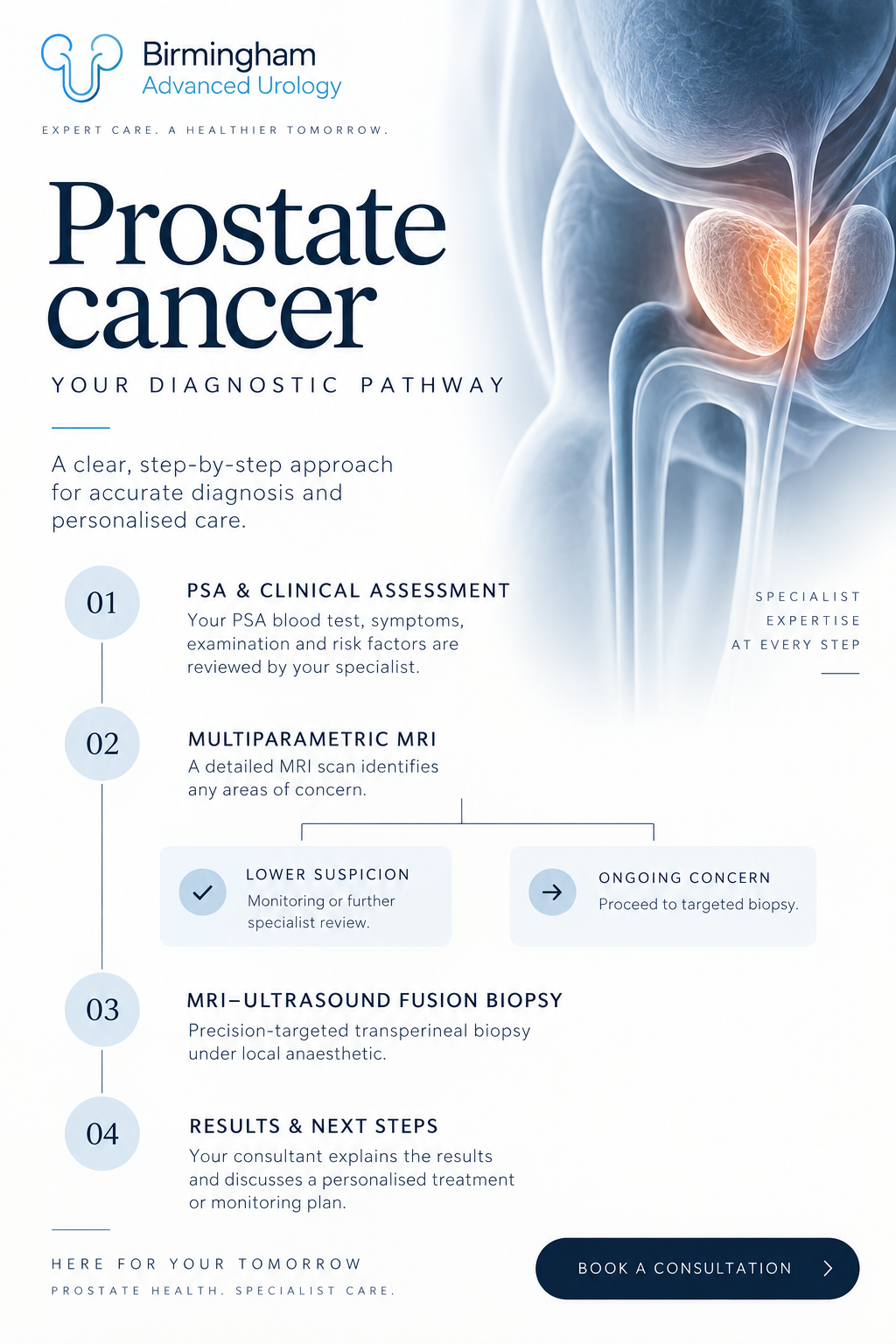 Birmingham Advanced Urology infographic showing a prostate cancer diagnostic pathway: PSA and clinical assessment, multiparametric MRI, review or monitoring after a lower-suspicion result, MRI-ultrasound fusion transperineal biopsy when indicated, and results with next steps.
