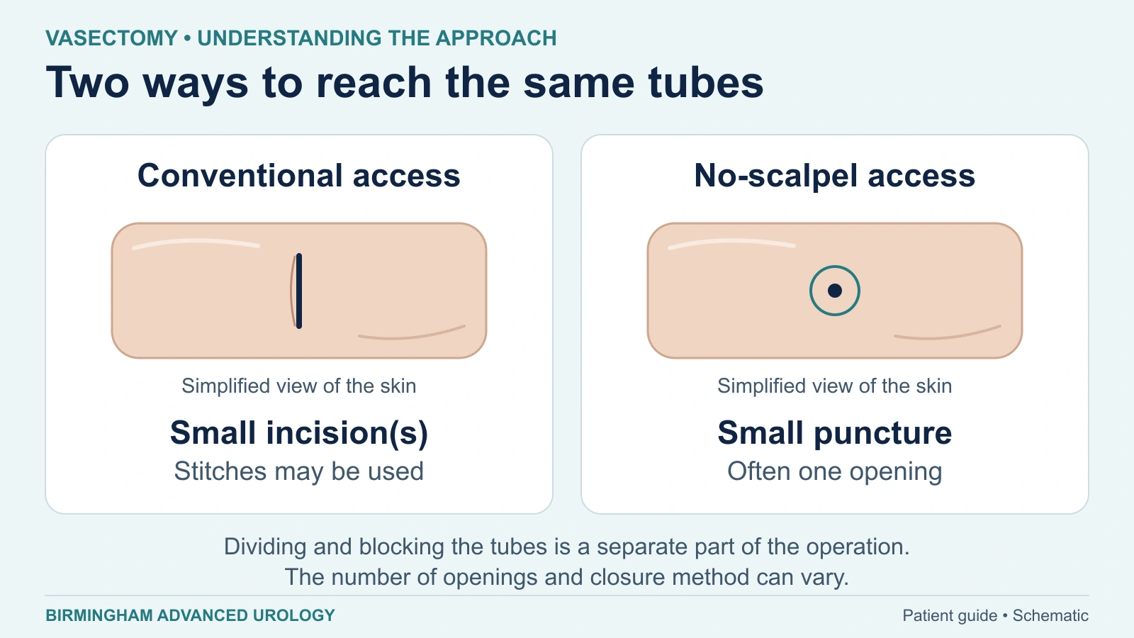 Simplified skin diagrams compare conventional incision-based access with a small no-scalpel puncture; blocking the tubes is a separate step.