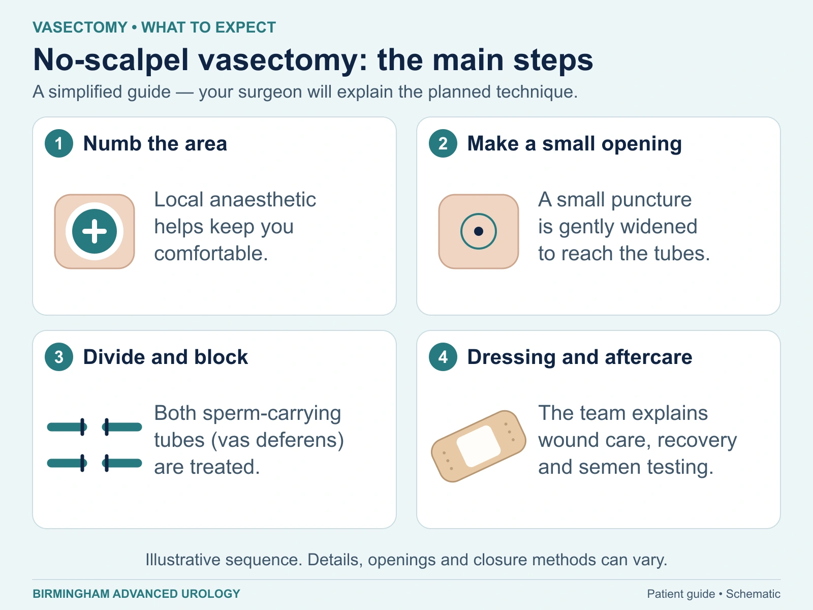 Four general stages: numb the area, make a small opening, divide and block both sperm-carrying tubes, then provide dressing and aftercare advice.